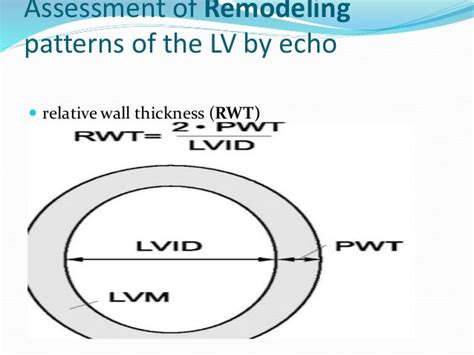 relative wall thickness calculator